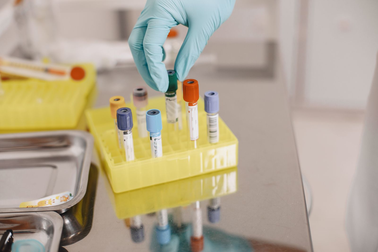 Biopsie lichida - eprubete pentru recoltarea de sange venos la NPA Constanta